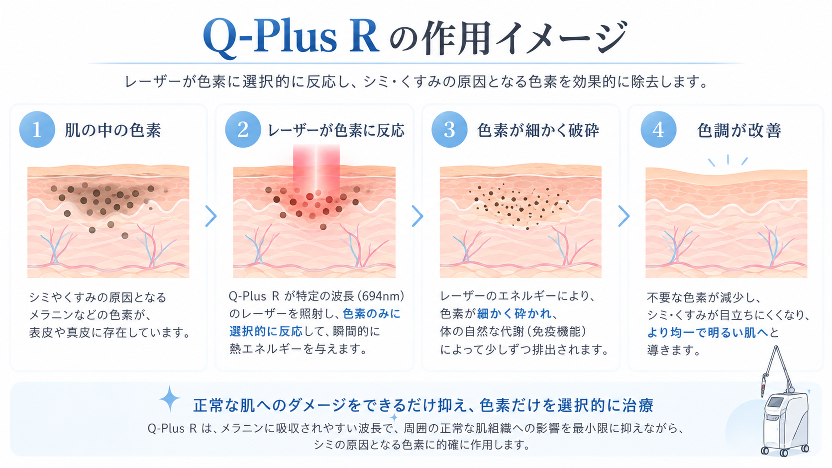 Q-Plus Rの作用イメージ。色素へのレーザー照射と色調改善の仕組み